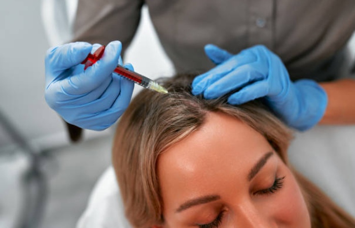 Additional Tips for a Happy Scalp