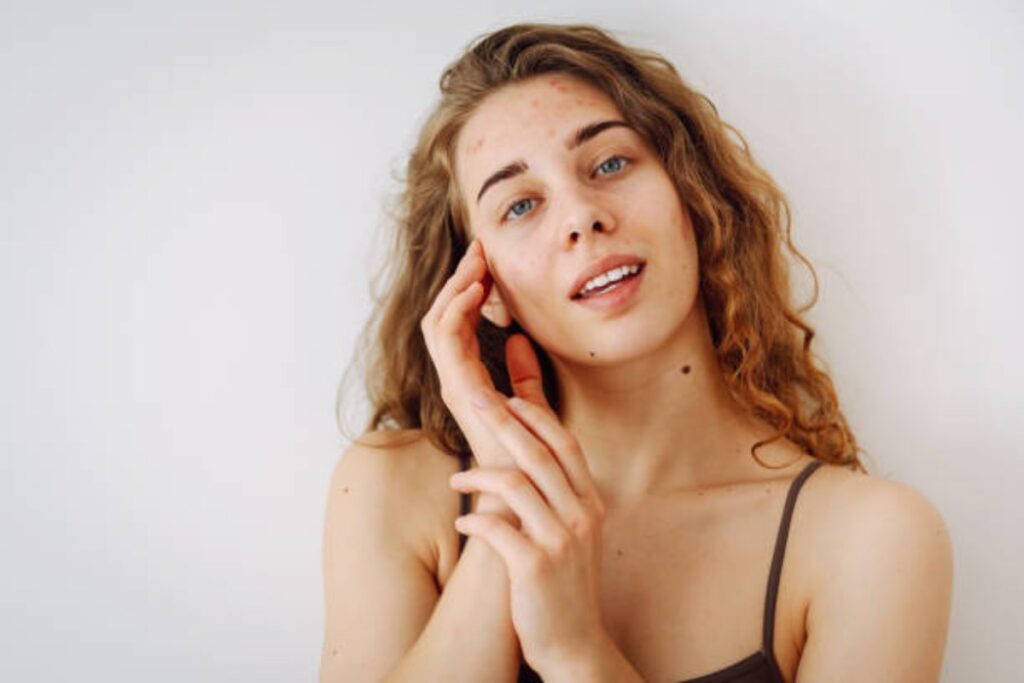 No-Makeup Look